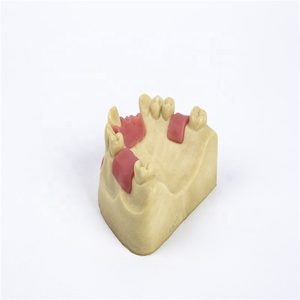 การสอนเข่า implant Model - Product Image 4