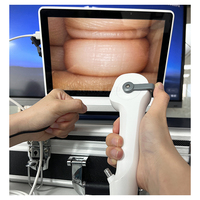 SY-P029-3 Endoscope de haute qualité Uretero-Renoscope Urologie Ureteroscope vidéo flexible à usage unique Ureteroscope jetable