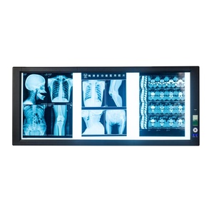 Xem duy nhất ánh sáng y tế LED duy nhất đôi X-Ray phim xem Illuminator ánh sáng người xem - Product Image 1