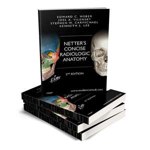 Netter's Concise Radiologic Anatomy 2 Impression de manuels médicaux personnalisés Reliure à coudre à petite quantité minimale de commande Reliure à reliure parfaite - Product Image 1