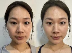 KXY Peptitleri Özlü Cilt Onarım Profesyonel Yüz Bakımı Liofilize Toz Yüz Kolajeni Onarır Yüz Kırışıklıklarını Azaltır - Product Image 3