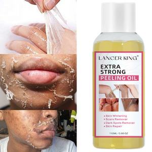 Aceite Exfoliante Amarillo Extra Fuerte para el Cuidado de la Piel del Cuerpo, Logotipo Privado Personalizado, Olor Fresco, Bajo MOQ de Fábrica - Product Image 2