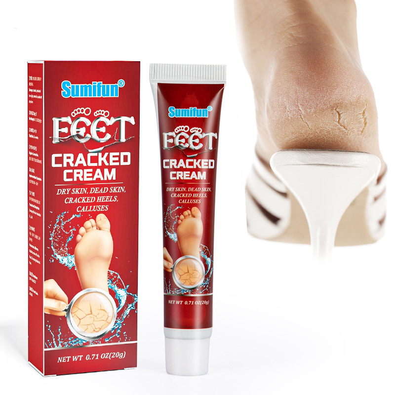 Новое поступление, кремовый крем для ног, увлажняет восстановление, удаление сухого растрескивания ног и рук, удаление омертвевшей кожи, мозолей, зимний крем для ухода за кожей
