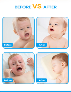 Produits de soin pour la peau de bébé, lotion éclaircissante pour l'eczéma, pour une peau <span class=keywords><strong>d</strong></span>'apparence saine - Product Image 5