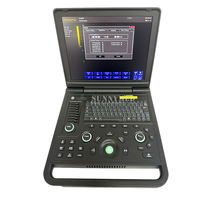 Machine à ultrasons portable échocardiographie noir et blanc Balayage animaux multisonde Machine à ultrasons numérique pour ordinateur portable