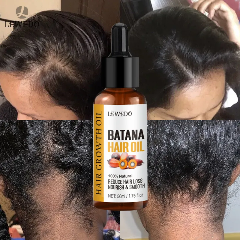 Nouvelle arrivée huile de Batana biologique pure naturelle en gros favorise la repousse des cheveux huile de Batana de cheveux crus en vrac pour la croissance des cheveux