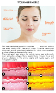 เทคโนโลยีใหม่ เครื่องเลเซอร์ CO2 Fractional 10600nm เครื่องตัดเลเซอร์ CO2 สำหรับการฟื้นฟูผิวหนัง อุปกรณ์ความงาม - Product Image 5