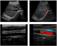 Échographe Doppler Couleur Sans Fil JZ-SWC9 - Appareil d'Imagerie Numérique de Poche Haute Résolution pour Diagnostic Médical