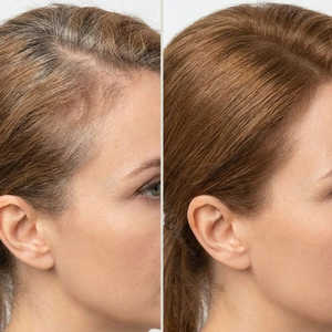 Couvre-cheveux gris - Couleur marron - Product Image 5