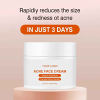 Crème Visage OEM ODM à Base de Plantes AHA Blanchissante Hydratante Soin de la Peau Réduction des Pores Contrôle du Sébum Élimination des Acnés et des Boutons