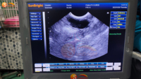 Mesin USG Portabel untuk Hewan Ternak Sapi Kuda dengan Probe Rektal, Pencitraan 2D/3D, Peralatan Obstetri untuk Penggunaan Hewan