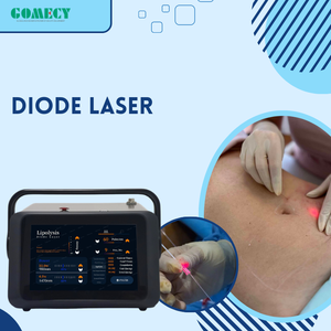 Láser de Diodo de Alta Calidad de 980nm para Eliminación de Vasos Sanguíneos/Vascular Facial/Várices - Product Image 1