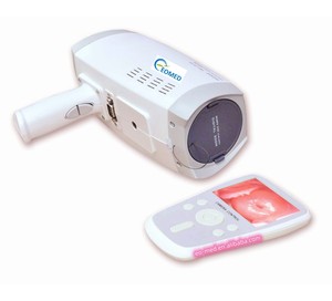 Draagbare Handheld Video Colposcoop DVC-9800B Inspectie Voor Vrouwelijke Gynaecologie <span class=keywords><strong>Vagina</strong></span> Onderzoek - Product Image 3