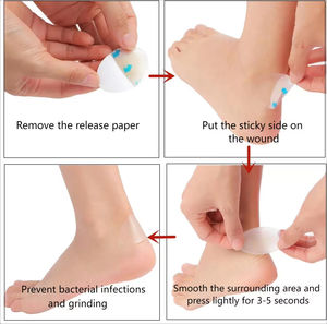 Pansement hydrocolloïde médical auto-adhésif pour talon, patch pour plaies et ampoules, désinfectant infrarouge lointain, certifié ISO13485 pour le soin des talons - Product Image 6