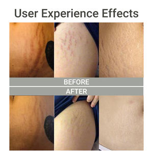 Crème <span class=keywords><strong>Anti</strong></span>-Vergetures Grossesse Marque Privée - Product Image 2