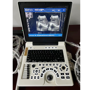 Máquina <span class=keywords><strong>de</strong></span> Diagnóstico por Ultrasonido en Blanco y Negro a <span class=keywords><strong>Precio</strong></span> <span class=keywords><strong>de</strong></span> Fábrica, Equipo <span class=keywords><strong>de</strong></span> Diagnóstico Veterinario en Oferta - Product Image 2