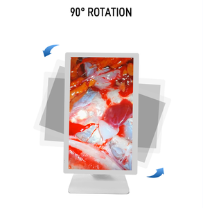 <span class=keywords><strong>TUYOU</strong></span> 32 Pulgadas 4K UHD Monitor Médico Endoscópico de Alta Definición Nuevo Diseño para Cirugía Equipo de Imágenes Médicas - Product Image 5