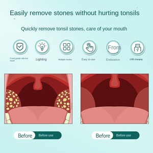 Kit Penghilang Batu <span class=keywords><strong>Tonsil</strong></span> Silikon Elektrik Carepik dengan 3 Mode & 5 Nozel untuk Perawatan dan Pembersihan Mulut - Product Image 4