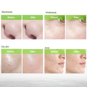 Mascarilla Facial Negra Exfoliante de Carbón para Limpieza Profunda y Eliminación de Puntos Negros OEM - Product Image 6