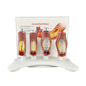 Vaso sanguigno malato modello SMM319 - Product Image 1