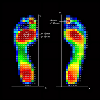 Analyseur de pression plantaire portable à technologie piézorésistive pour l'analyse de la distribution de la pression plantaire en cycle de marche et les tests de marche statique et dynamique