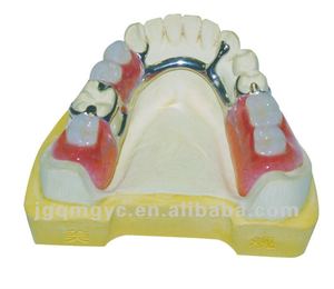 Todo Tipo de dentaduras postizas removibles personalizadas Restauración no invasiva Dientes faltantes Cómodo de usar - Product Image 4