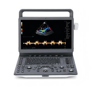 Sistema de Ultrasonido Veterinario Portátil XY M70VET con Imágenes Doppler a Color, Cálculo Inteligente y Gestión de Informes - Product Image 3