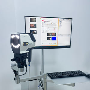 स्त्री रोग विज्ञान और गर्भाशय जांच के लिए fhd इमेजिंग के साथ YKD-3003 डिजिटल एचडी कोलोपोस्कोप - Product Image 2