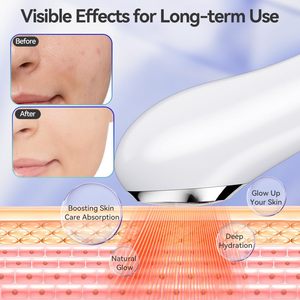 Xách tay liệu pháp ánh sáng đỏ chăm sóc da công cụ 630nm 850nm 3 cường độ Sonic Microcurrent Spa nhà - Product Image 4