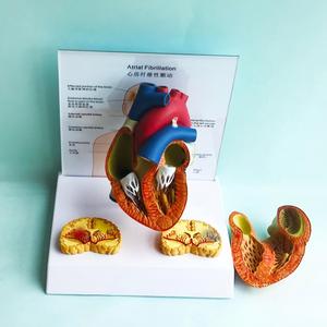 Modelo Anatómico de Fibrilación Atrial con Secciones Transversales de Corazón y Cerebro para la Enseñanza de Cardiología - Product Image 4