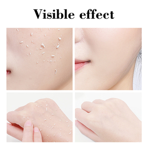 Gel <span class=keywords><strong>Esfoliante</strong></span> al Tè Bianco e Sale Marino 600ml, Scrub Viso e <span class=keywords><strong>Corpo</strong></span>, Gel Detergente <span class=keywords><strong>Esfoliante</strong></span> per Rimozione Pelle Morta, Cura della Pelle - Product Image 5