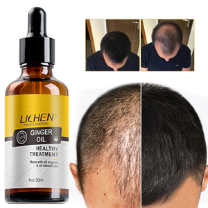 Professionnel haut de gamme huile capillaire pour <span class=keywords><strong>cheveux</strong></span> abîmés pur huile d'argan cosmétique naturel produits pour <span class=keywords><strong>cheveux</strong></span> femmes noires - Product Image 2