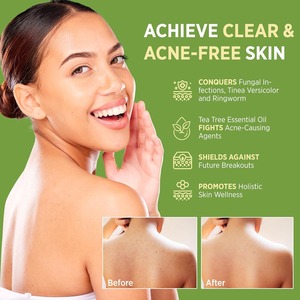 Jabón <span class=keywords><strong>Artesanal</strong></span> Hidratante con <span class=keywords><strong>Aceite</strong></span> Esencial <span class=keywords><strong>de</strong></span> Árbol <span class=keywords><strong>de</strong></span> Té y Romero, Antifúngico y Antibacteriano, con Logotipo Personalizado, para Rostro y Cuerpo, Suave - Product Image 3
