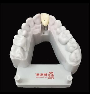 Prothèses dentaires d'<span class=keywords><strong>implant</strong></span> adaptées au système d'implantation traditionnel en <span class=keywords><strong>zircone</strong></span> ou couronne Pfm à des <span class=keywords><strong>prix</strong></span> abordables - Product Image 3