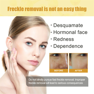 Jaysuing crème éclaircissante speckile chloasma enlever hydratant meilleure qualité blanchissant anti-taches crème - Product Image 5