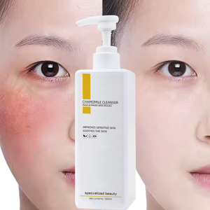 <span class=keywords><strong>Limpiador</strong></span> <span class=keywords><strong>facial</strong></span> de manzanilla caliente de Vietnam, <span class=keywords><strong>limpiador</strong></span> eficaz antibacteriano para enrojecimiento de <span class=keywords><strong>piel</strong></span> <span class=keywords><strong>sensible</strong></span>, <span class=keywords><strong>limpiador</strong></span> de poros para espinillas - Product Image 1