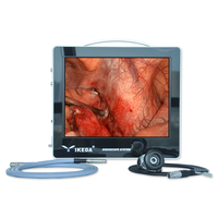 Caméra d'endoscopie ORL compacte tout-en-un IKEDA 9115E avec capteur FHD 1/2.8" et alimentation électrique