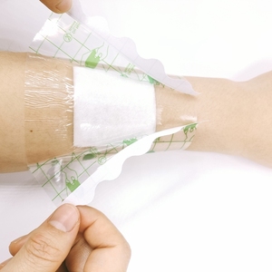 Cuidado posterior de tatuajes a prueba de agua con película de poliuretano, película de PU transparente, 10 cm X 10M - Product Image 2