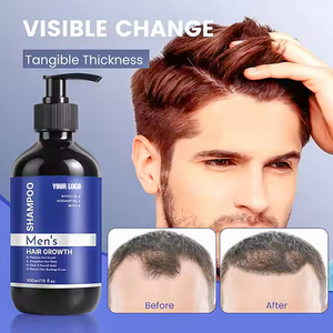 Champú para pérdida de cabello fortalecedor <span class=keywords><strong>sin</strong></span> sulfato de etiqueta privada personalizada Champú anticrecimiento con características suavizantes y refrescantes - Product Image 5