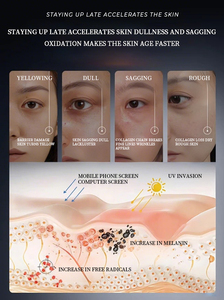 Burbuja de oxígeno carbonatada, espuma de limpieza hidratante profunda coreana, limpiador Facial Inno, máscara de Gel de eliminación de espinillas purificante facial - Product Image 2