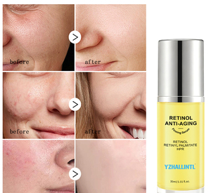 Essência Hidratante para Cuidados com a Pele OEM com Logo Personalizado, Sérum Facial <span class=keywords><strong>Anti</strong></span>-envelhecimento com Ácido Hialurônico e Retinol - Product Image 4