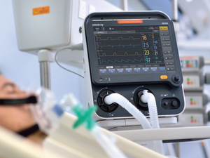 Ventilator ICU Mindray SV300 Multi Mode Berpenggerak Turbin untuk Penggunaan Transportasi ICU Terapi Oksigen Aliran Tinggi Penggunaan Pediatrik dan Dewasa - Product Image 2