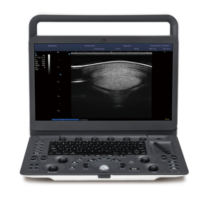 เครื่องอัลตราซาวด์สีแบบพกพา Sonoscape E2V สำหรับสัตวแพทย์ - Product Image 6