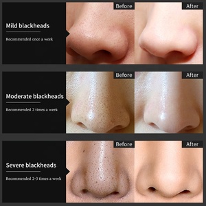 Oem ODM tre than hoạt tính giữ ẩm Làm Trắng Mặt nạ Mặt nạ làm sạch sâu Mặt nạ chăm sóc da đen Sản phẩm tự nhiên - Product Image 5