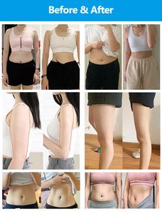 การลดไขมันแบบไม่เจ็บปวด พร้อมบริการปรับแต่งได้สำหรับหน้าท้อง แขน ต้นขา สะโพก และบริเวณไขมันฝังลึกอื่นๆ - Product Image 6