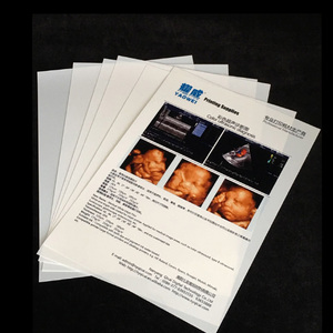 Film médical blanc de haute qualité 11x14 pour impression jet d'encre sur support PET, compatible avec Epson et <span class=keywords><strong>Canon</strong></span> pour échographie - Product Image 2