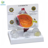 Modelo de Ojo Anatómico Premium de PVC, 3 Partes, 3D, con Cataratas, para Enseñanza, Diseño Desmontable de 3 Partes