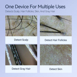 Samairay ponsel Android USB WIFI, telepon genggam terhubung HD deteksi folikel rambut putih detektor perawatan kulit kepala untuk penggunaan di rumah - Product Image 5
