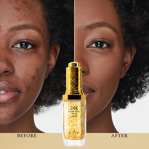 Custom 24k <span class=keywords><strong>Gold</strong></span> Beauty Skincare Essência Refirmante Pele Rosto Soro Anti-Rugas Hidratante Para Círculo Escuro