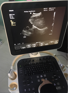 Fourniture et réparation de machine à ultrasons CV550 ,CV580 ,CV650, carte ACQ CV850, carte de canal, carte CB, alimentation de carte PC - Product Image 3